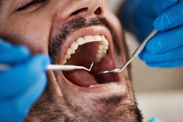 Best Emergency Dental Surgery in Farmer City, IL