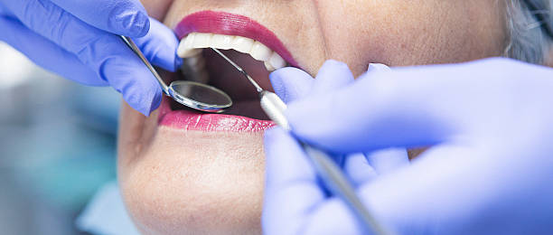 Best Emergency Tooth Extraction in Farmer City, IL